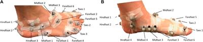 In-silico techniques to inform and improve the personalized prescription of shoe insoles